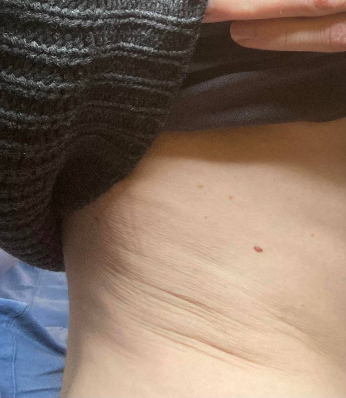 włókna elastyny i kolagenu w skórze twarzy pod mikroskopem
