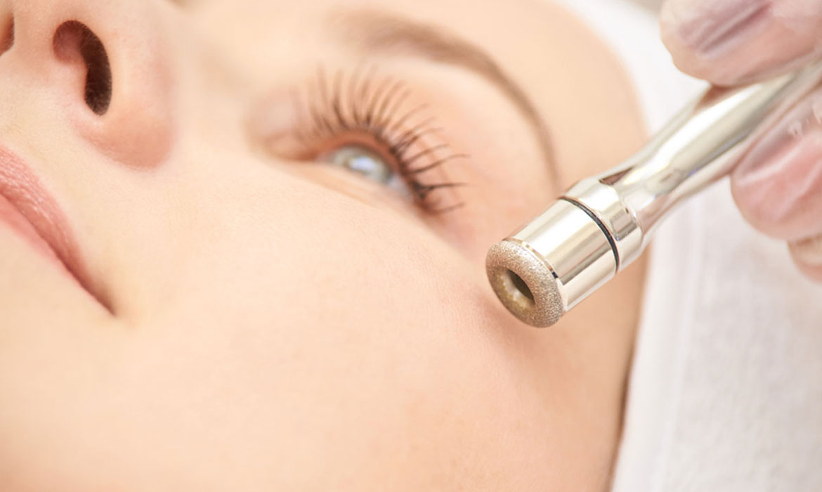 redukcja zmarszczek po mikrodermabrazji zmarszczki mimiczne wokół oczu zmniejszone po serii mikrodermabrazji diamentowej na twarzy