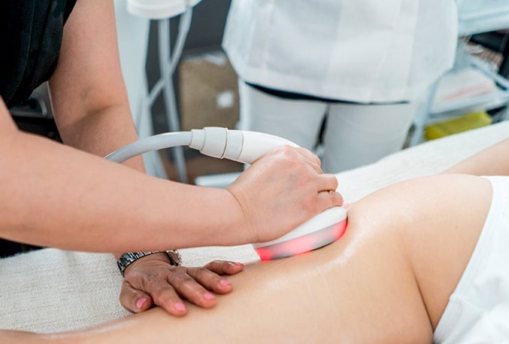 kobieta na kozetce z głowicą ultradźwiękową na brzuchu podczas zabiegu kawitacyjnego